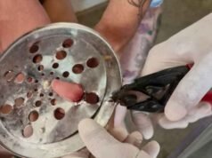 Atenção pais! Criança de 2 anos fica com dedo preso em ralo e é socorrida pelos bombeiros