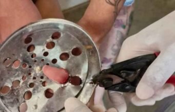 Atenção pais! Criança de 2 anos fica com dedo preso em ralo e é socorrida pelos bombeiros